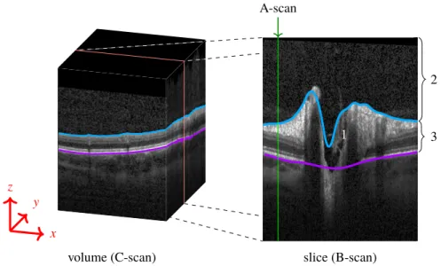 Fig. 1. (Left) Volume scan (C-Scan) of the optic nerve head (ONH). (Right) The volume scan consists of slices (B-scans), where each column is an axial depth scan (A-Scan)