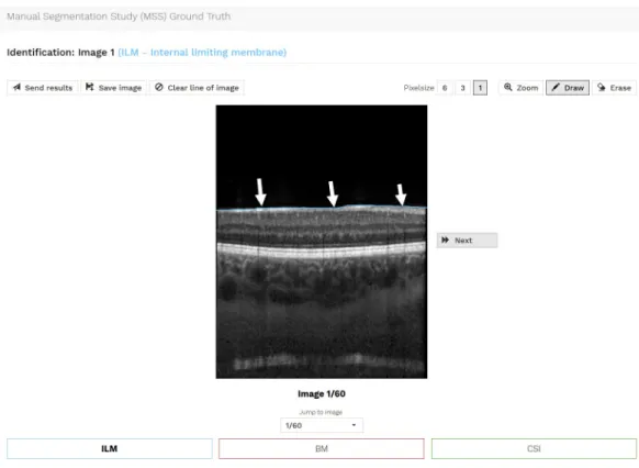 Fig 1. Illustration of the online annotation tool used for manual OCT image compartmentalization