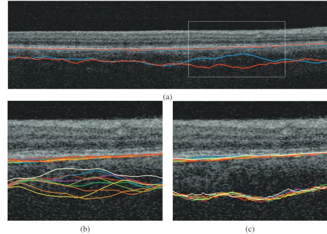 Figure 9 shows the 3D and 4D thickness measurements per patient, over the course of the seven time points
