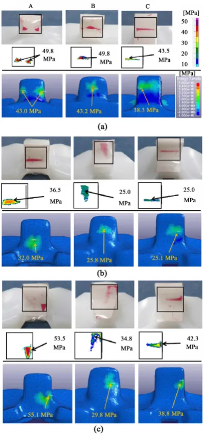 Figure 4.  Surface pressure distribution. Top: Finite element analysis. Bottom: Pressure images were determined using analysis system