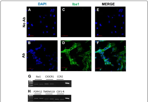 Fig. 4 HMC3 cell expression of microglial lineage markers. a–f Representative example of confocal images (1024 × 1024 pixels) acquired at × 20magnification with a confocal laser scanning system (A1+, Nikon)