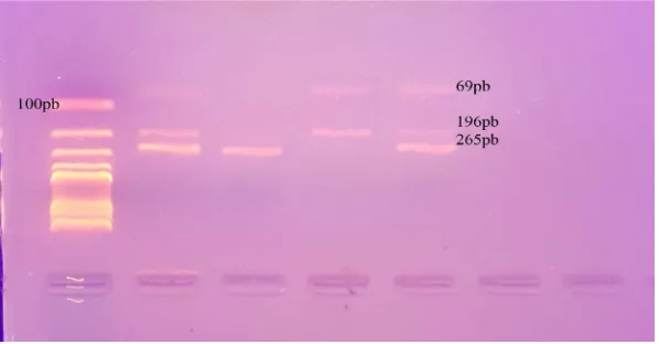 Figure 1. Gel electrophoresis of PCR-RFLP technique of amplified FOKI geno-ment of 265 bp; Lane 3: Represent the homozygous ff genotype showing 2 frag-types