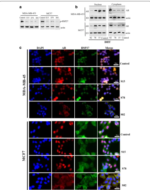 Fig. 5 The critical sites of HSP27 phosphorylation for AR cytoplasmic/nuclear translocation