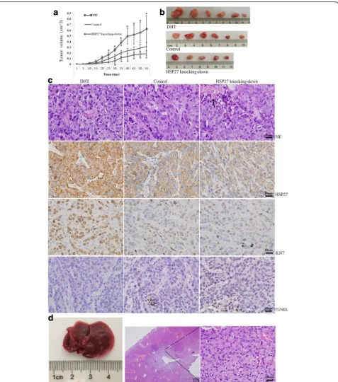 Fig. 6 HSP27 and DHT affected the tumor formation and metastasis in vivo using MDA-MB-453 cells
