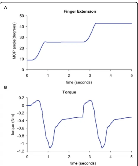 Figure 7 Extension movement performed by Subject 2motion was halted by the motors and the subject was able to relaxthe flexors and then further extend the hand