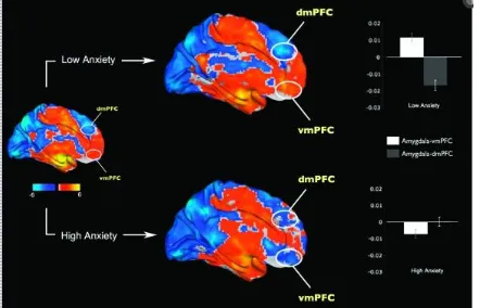 Figure 1 and vmPFC at rest in socially anxious individuals and increased connectivity between amygdala and dmPFC in low anxious subjects