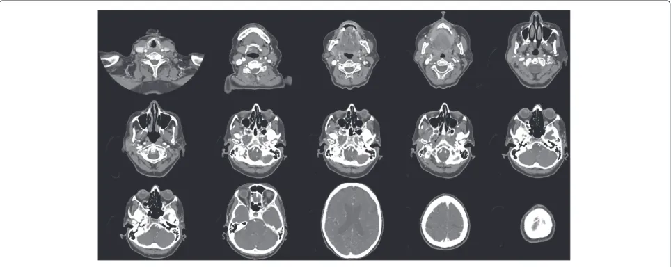 Figure 8 Results of segmentation experiments using diﬀerent values of inter-node spacing, number of necessary iterations (left) andexecution times in seconds (right).