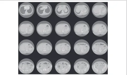 Figure 11 Results of the experiments with real medical images—execution times of the segmentation algorithms.