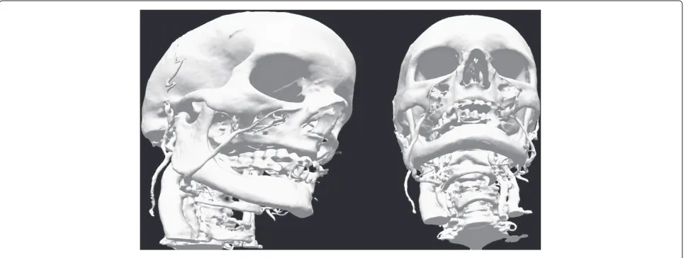 Figure 12 Results of the experiments with real medical images—iterations required to perform a full segmentation.