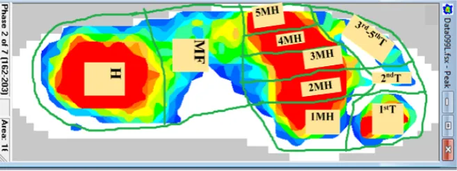 Figure 1. Foot pressure sampling location. 