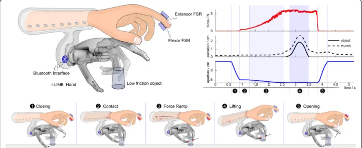 Figure 1 The ‘Grasp and Lift’ paradigm with our Closed-Loop prosthetic hand. Healthy subjects were fitted with a modified i-limb Pulse prosthetic hand with a two-channel differential force controller