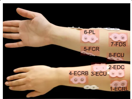 Figure 6 Electrode positions.