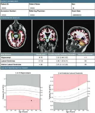 FIG 1. Brain MR imaging evaluation of a patient with amnestic MCI by use of a volumetricsagittal T1-weighted MR images
