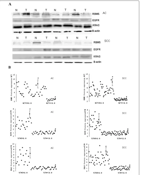 Figure 2 Expression of RBM5, EGFR and KRAS protein in NSCLC. A, Western blot of RBM5, EGFR and KRAS protein expression inrepresentative tissue samples from NSCLC and non-tumor specimens