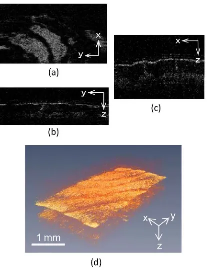 Figure 6. High-speed en face OCT images of human fingerprint. (a) En face OCT image structed 3D-OCT.of x-y plane; (b) OCT image of the y-z plane; (c) OCT image of x-z plane; (d) Con-  