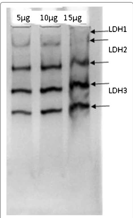 Figure 4 Native PAGE (8%) showing enzyme activity of lactatedehydrogenase (LDH) in the serum of gallbladder cancerpatients.