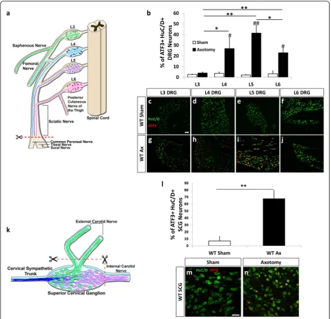 Fig. 1 The axonal injury-induced marker ATF3 is highly upregulated in L4, L5, and L6 DRG and in the SCG 7 days after axotomy