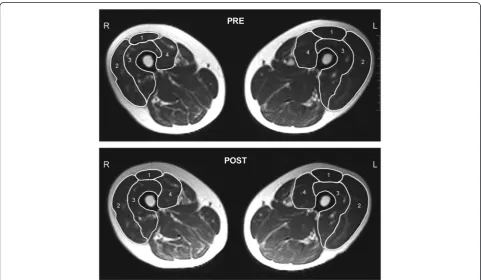 Fig. 2 Stroke patient performing resistance exercise on a flywheel leg press device