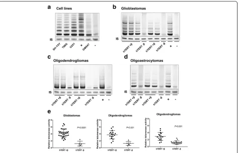 Fig. 2 Relative telomerase activity in human gliomas and cell lines.of human gliomas was significantly consistent with the expression of hTERT+ a Telomerase activity was detected by TRAP assay, and all four cell lines exhibitedhigh TA