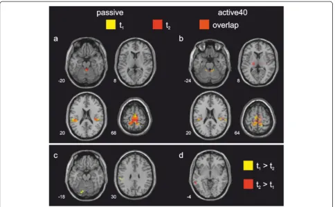Fig. 3 Activation maps during passive and active40 stepping.the bottom left of each section, images are displayed in neurological convention (i.e., left is left), Top row: Regions of significant BOLD signal increase during passive (a) and active40(b) stepp