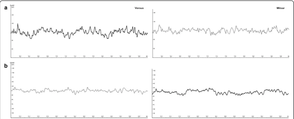 Fig. 9 Slow-wave artifact patterns. Three-second sample of central slow-wave artifacts observed during the eyes-open simultaneous EEG recordings oftwo participants, left panel = Versus dry electrode, right panel = Mitsar wet electrode