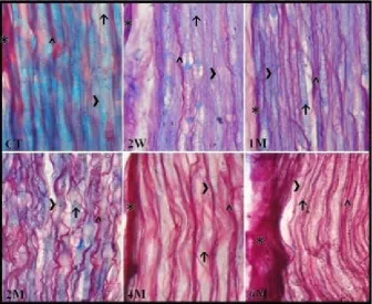 Table 1. Quantitative changes in the myelinated axons of the sciatic nerve in diabetic animals as compared with age-matched  control groups (number ± standard deviation; N = 6 for each group)