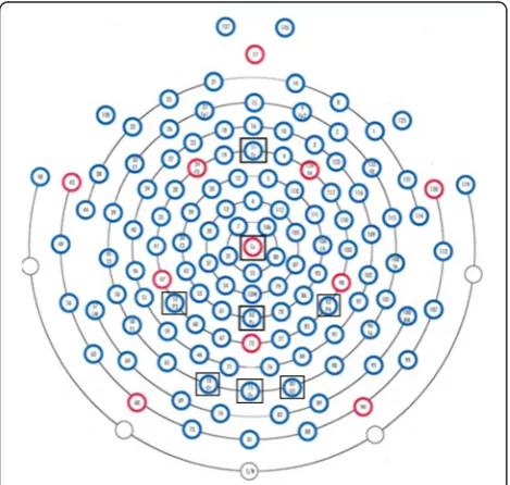 Fig. 2 Electrode placement (HydroCel Geodesic Net)
