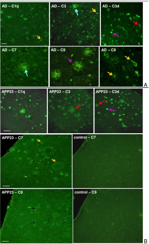 Figure 4Complement immunostaining of AD and APP23 mouse brainNeocortex of a 20 months old female APP23 mouse: C1q, C3 and C3d immunostaining of diffuse (red arrow) and com-pact (violet arrow) amyloid plaques; C7 immunostaining of the amyloid plaque periphe