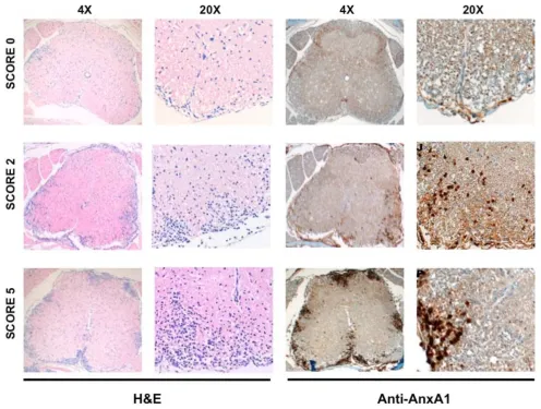 Figure 1AnxA1 expression correlates with the severity of EAEspinal cords removed at day 12 (score 0), day 18 (score 2) and (AnxA1 expression correlates with the severity of EAE