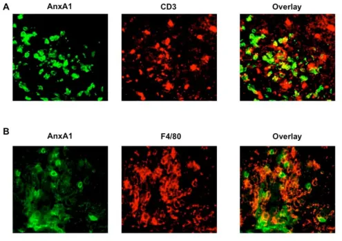Figure 2Cellular phenotype of AnxA1 expressing cells in spinal cord sections of mice with severe EAEAnxA1 and anti-CD3 (Cellular phenotype of AnxA1 expressing cells in spinal cord sections of mice with severe EAE