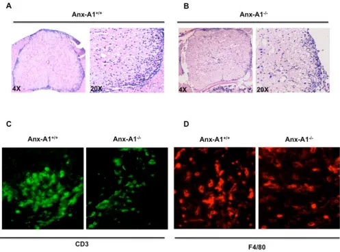 Figure 7Histological changes in spinal cord sections of MOG35-55-immunized AnxA1-/- miceHistological changes in spinal cord sections of MOG35-55-immunized AnxA1-/- mice