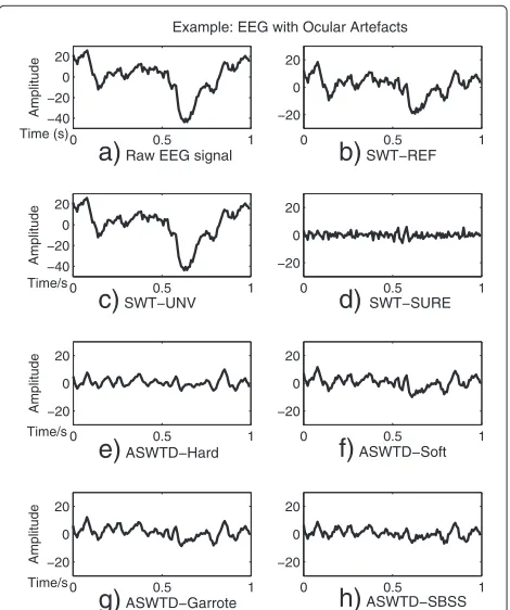 Figure 8 presents the MSE and spectral distortion (PSDfor diﬀerent artefact removal algorithms when semi-added) are used