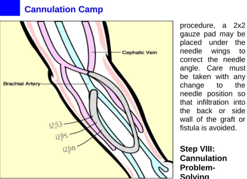 Figure 10. Bedside cannulation chart, showing dates and  locations of prior puncture sites