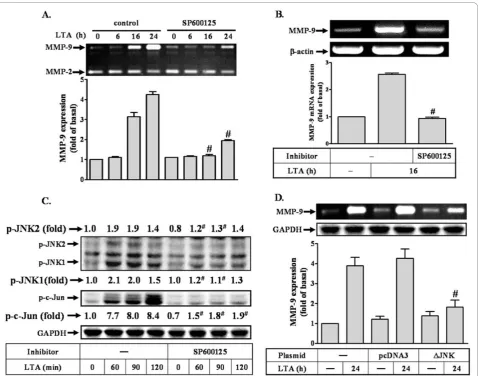 Figure 2 LTA-induced c-Jun phosphorylation is mediated through JNK in RBA-1and then incubated with 50