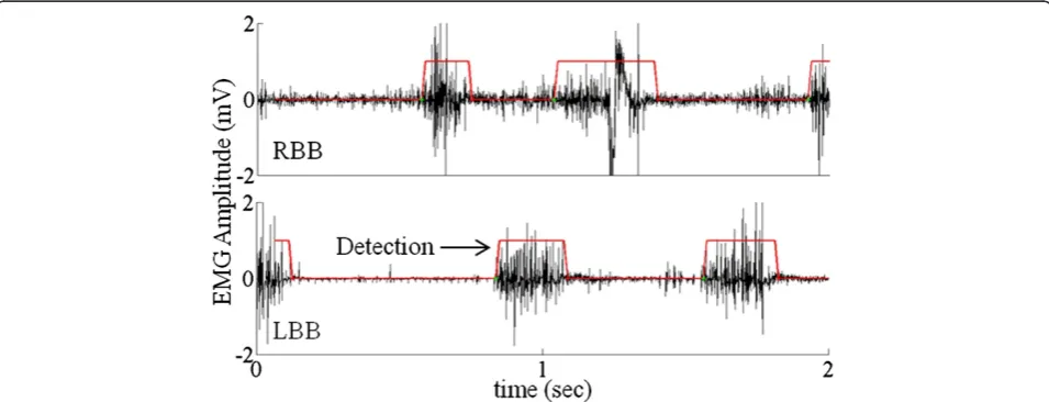 Figure 4 Detection of EMG activity using the FFT technique. EMG activity from RBB and LBB superimposed with activity detection (shown bythe red lines) using the frequency analysis algorithm (also see Figure 3v and vi)