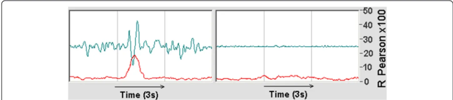 Fig. 8 Case 1. Left: W(C, X, J) from ERP pure wave + random noise, Jitter = 0, average of 100 ERPs