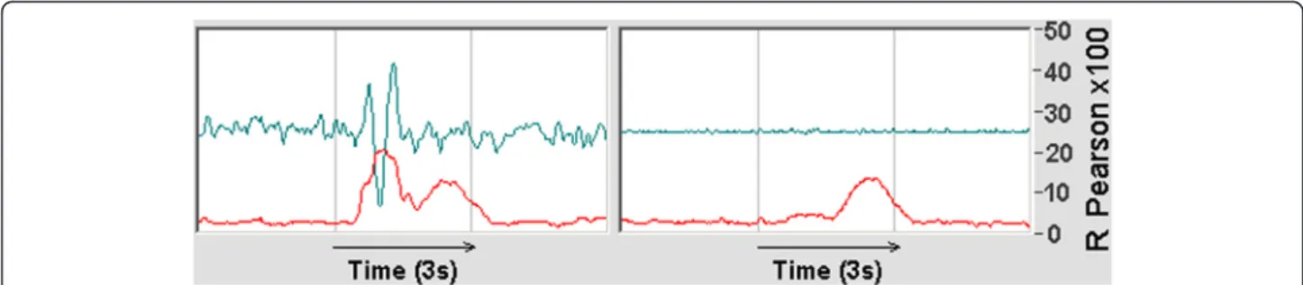 Fig. 10 Case 3. Left: W(C, X, J) from ERP pure wave + random noise, Jitter = 0, RCS width about 400 ms, average of 100 ERPs