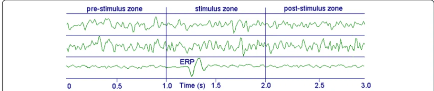Fig. 1 The two upper tracks represent the raw signals of two EEG channels in time-locked epochs, whereas the lower track is the average of a sufficient number (about 100) of epochs for each channel (ERP is not to scale)