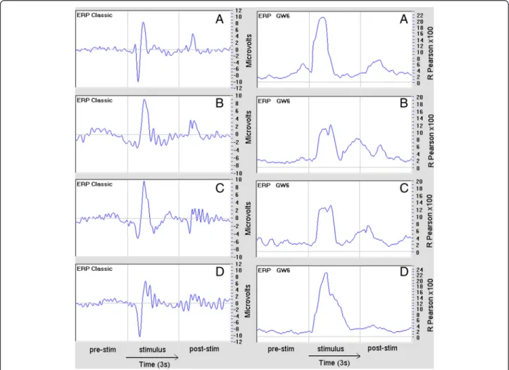 Fig. 3 In these pictures, shown as examples, the left presents the classic ERP (amplitude in microvolts)