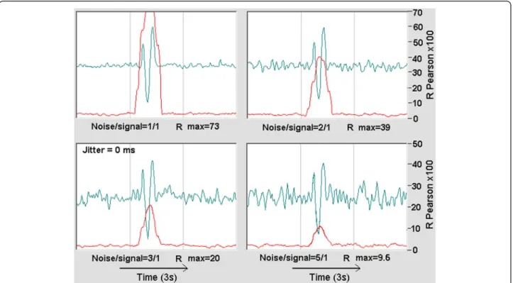 Fig. 5 Example of the ERP + random signal emulation for four levels of noise-to-signal ratio