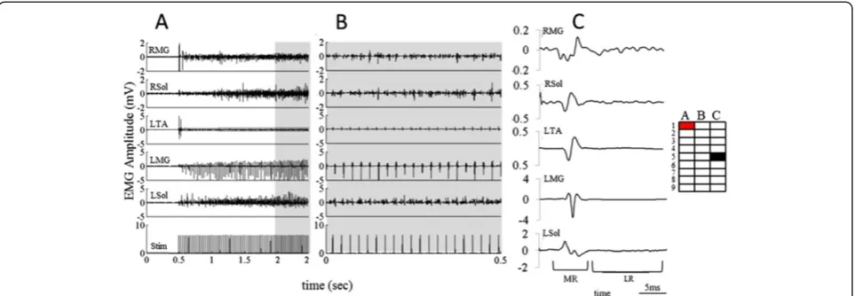 Figure 7 EMG response to stimulation at rostral electrodes on the array during standing