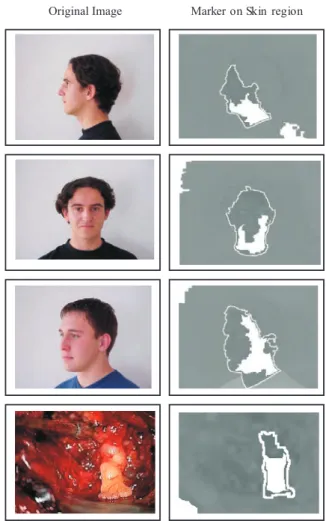 Fig. 4. Marker on Skin Region Corresponding of Original Input Image.