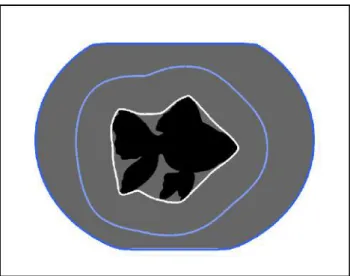 Figure 2: Illustration of two-stage snake: Initialization (white line), inter- inter-mediate steps (light blue line) and final segmentation (dark blue line).