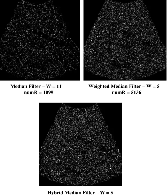 Figure 6.5 : The results of the watershed algorithm on preprocessed liver image  using different filtering methods and window sizes