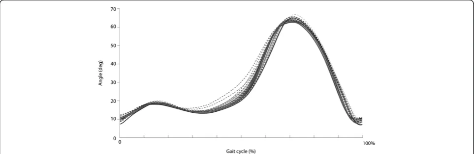 Figure 4 Activation signals for different speeds and BWS forrobot-aided walking and for overground walking (solid line),averaged over all subjects