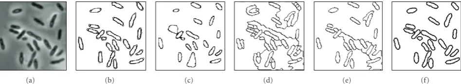 Figure 9: Segmented results of the “bacteria” image. (a) Original image. (b) Result obtained by the LWOF method
