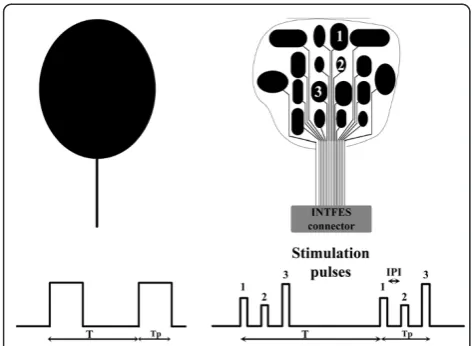 Figure 2 Stimulation paradigm with single-pad electrode (leftpanel) and multi-pad electrode (right panel)