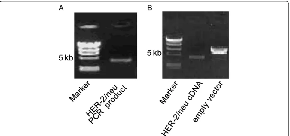 Figure 1 RT-PCR and digestion products. A. HER-2/neu RT-PCR, Marker: λ-HindIII DNA marker; B