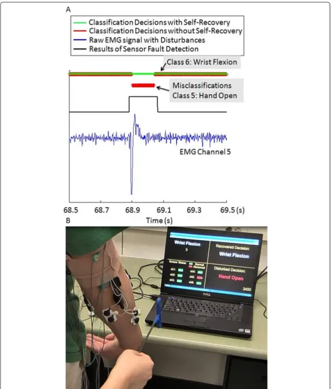 Figure 7 Real-time performance of the self-recovery system. (A): Real-time system performance of a segment of a representative CA trial;(B): A screenshot from the video that recorded the corresponding CA trial presented in (A)