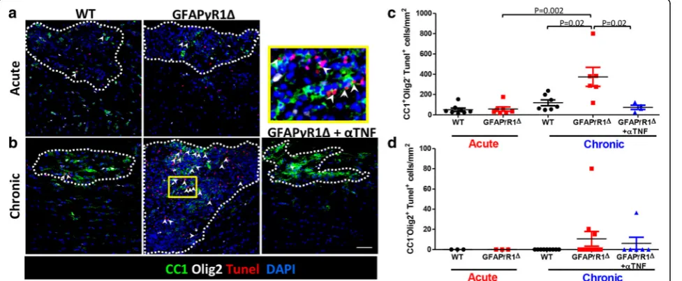 Fig. 2 TNF neutralization limits OLG apoptosis during progressive EAE in GFAPγR1Δ mice